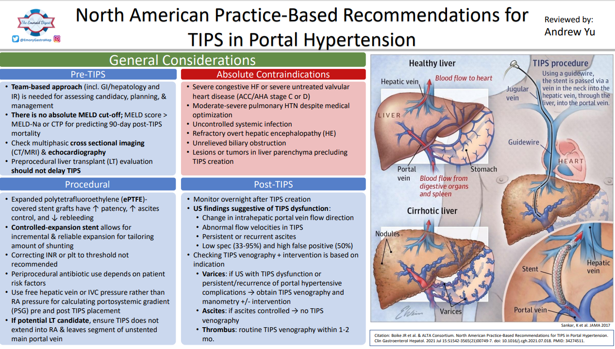 Necrotizing Pancreatitis Visual Abstract 